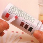 test urine