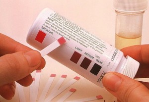 test urine