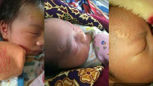 Lahir dari Keluarga Kurang Mampu, Bayi ini Punya Lafal Allah di Dahi